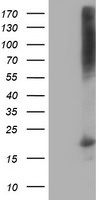 DSTN Antibody in Western Blot (WB)