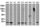 DSTN Antibody in Western Blot (WB)