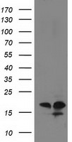 DSTN Antibody in Western Blot (WB)