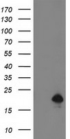DSTN Antibody in Western Blot (WB)