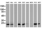 DSTN Antibody in Western Blot (WB)