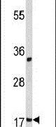 Destrin Antibody in Western Blot (WB)