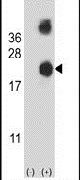 Destrin Antibody in Western Blot (WB)
