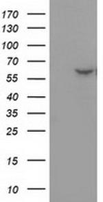 DTNA Antibody in Western Blot (WB)