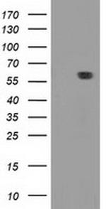 DTNA Antibody in Western Blot (WB)