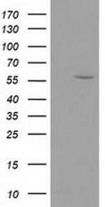 DTNA Antibody in Western Blot (WB)