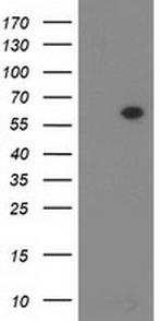 DTNA Antibody in Western Blot (WB)