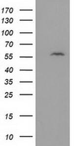 DTNA Antibody in Western Blot (WB)