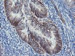 DTNB Antibody in Immunohistochemistry (Paraffin) (IHC (P))