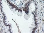 DTNB Antibody in Immunohistochemistry (Paraffin) (IHC (P))