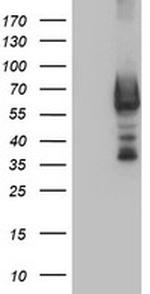 DTNB Antibody in Western Blot (WB)