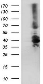 DTNB Antibody in Western Blot (WB)