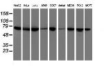 DTNB Antibody in Western Blot (WB)