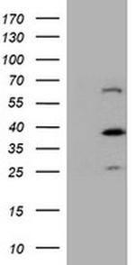DTNB Antibody in Western Blot (WB)