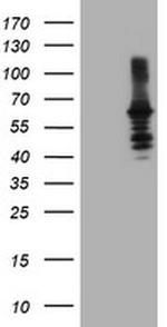 DTNB Antibody in Western Blot (WB)
