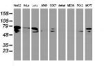 DTNB Antibody in Western Blot (WB)