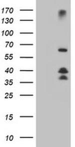 DTNB Antibody in Western Blot (WB)