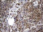 DTWD1 Antibody in Immunohistochemistry (Paraffin) (IHC (P))