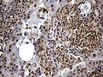 DTWD1 Antibody in Immunohistochemistry (Paraffin) (IHC (P))