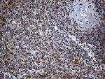 DTWD1 Antibody in Immunohistochemistry (Paraffin) (IHC (P))
