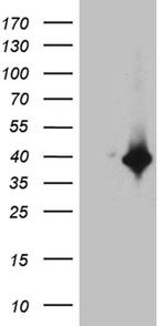 DTWD1 Antibody in Western Blot (WB)