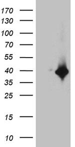 DTWD1 Antibody in Western Blot (WB)