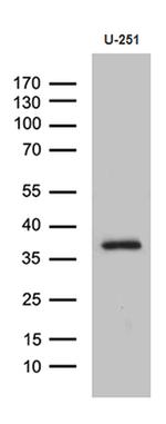 DTWD1 Antibody in Western Blot (WB)