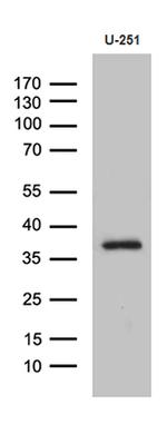 DTWD1 Antibody in Western Blot (WB)