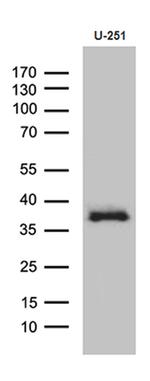 DTWD1 Antibody in Western Blot (WB)