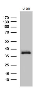DTWD1 Antibody in Western Blot (WB)