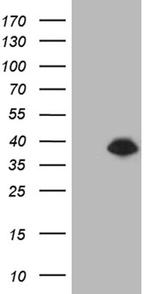 DTWD1 Antibody in Western Blot (WB)