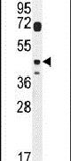 DTWD2 Antibody in Western Blot (WB)