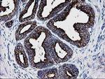 DTYMK Antibody in Immunohistochemistry (Paraffin) (IHC (P))