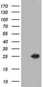 DTYMK Antibody in Western Blot (WB)