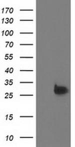 DTYMK Antibody in Western Blot (WB)