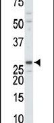 DTYMK Antibody in Western Blot (WB)