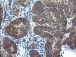 DUPD1 Antibody in Immunohistochemistry (Paraffin) (IHC (P))