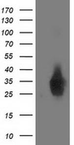 DUPD1 Antibody in Western Blot (WB)