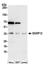 DUSP12 Polyclonal Antibody