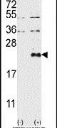 DUSP13 Antibody in Western Blot (WB)