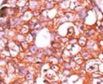 DUSP14 Antibody in Immunohistochemistry (IHC)