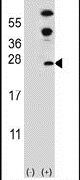 DUSP14 Antibody in Western Blot (WB)
