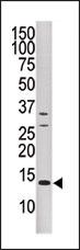 DUSP15 Antibody in Western Blot (WB)