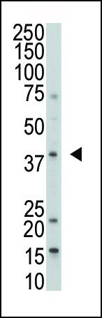 MKP-1 Antibody in Western Blot (WB)