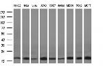 DUSP23 Antibody in Western Blot (WB)