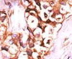 DUSP8 Antibody in Immunohistochemistry (IHC)