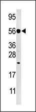 DUSP8 Antibody in Western Blot (WB)