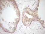 DVL2 Antibody in Immunohistochemistry (Paraffin) (IHC (P))