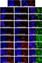 DYKDDDDK Tag Antibody in Immunocytochemistry (ICC/IF)
