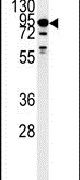 DYRK1A Antibody in Western Blot (WB)